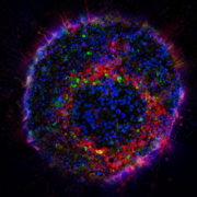 Neuroblastom Organoid (Minitumor)