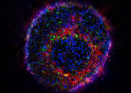 Neuroblastom Organoid (Minitumor)