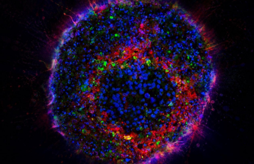 Neuroblastom Organoid (Minitumor)